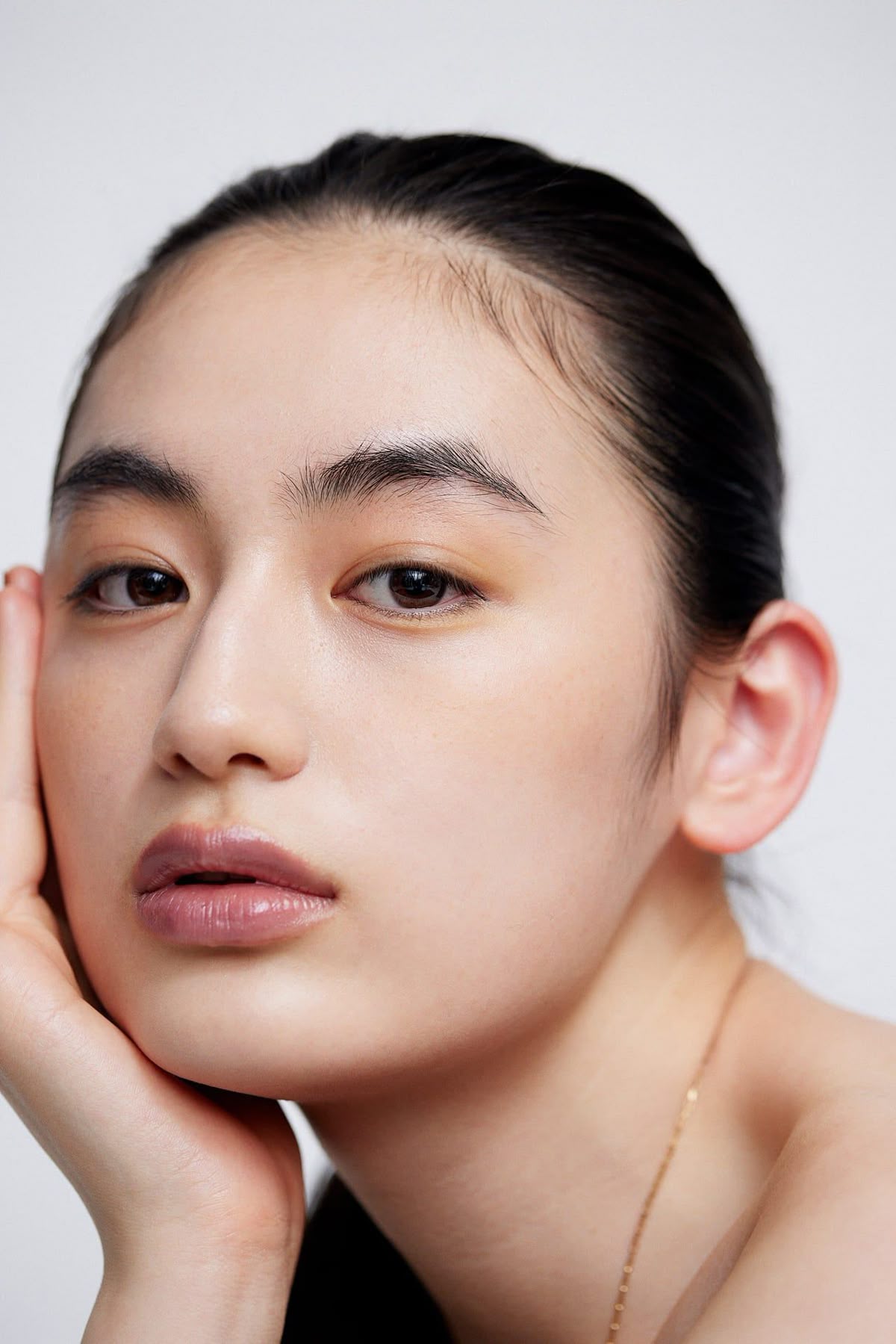 Laser Bekas Jerawat: Cara Kerja & Hasilnya