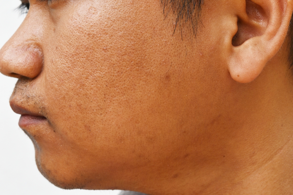 Wajah Pria Terlihat Kusam? Ini Penyebabnya