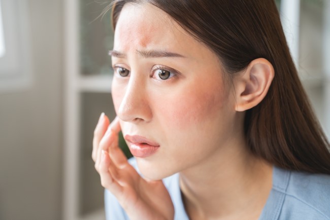 Kulit Kering dan Kusam? Ini Penyebab dan Faktor Utamanya