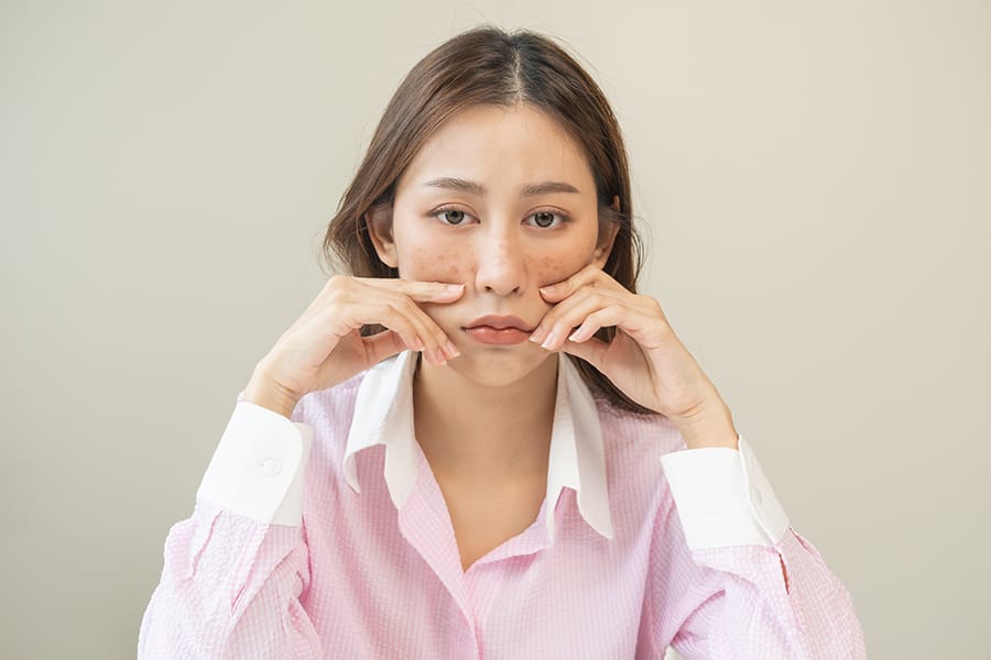 Kulit Menjadi Semakin Sensitif? Ini Penyebab Utama dan Cara Mengatasinya