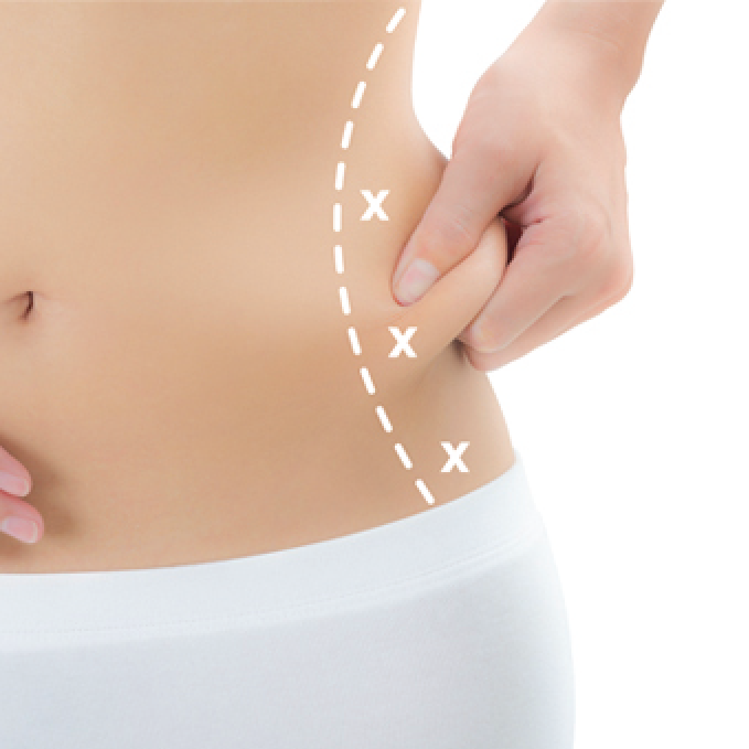Slimming Treatment & Slimming Injection: Solusi Ampuh atau Sekadar Tren?