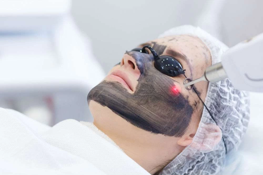 Panduan Lengkap Biaya dan Jenis Perawatan Laser Wajah di Reglow Clinic by dr Shindy Putri